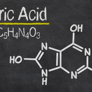 FDA Begins Review of OPKO's NDA Application for Rayaldee FDA Begins Review of OPKO's NDA Application for Rayaldee