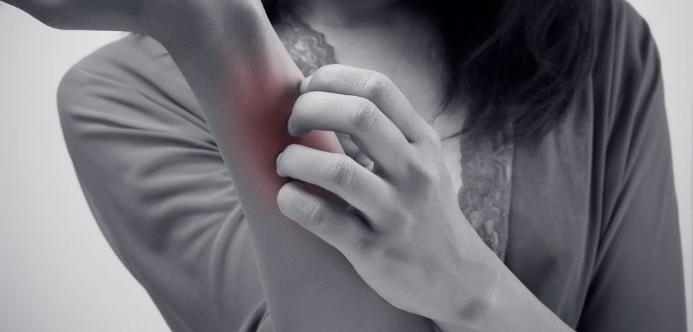 Itching Caused by CKD, Often Overlooked, May Have Treatments on the Way